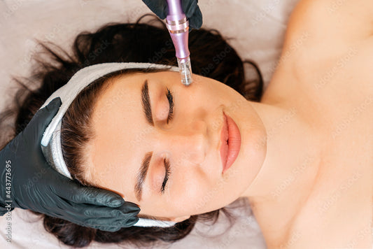 The Ultimate Guide to Purchasing a Microneedling Device