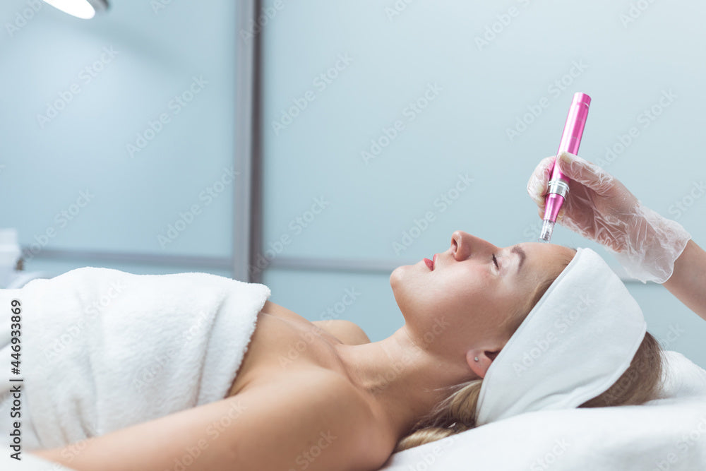The Best Microneedling Devices for Professional Use
