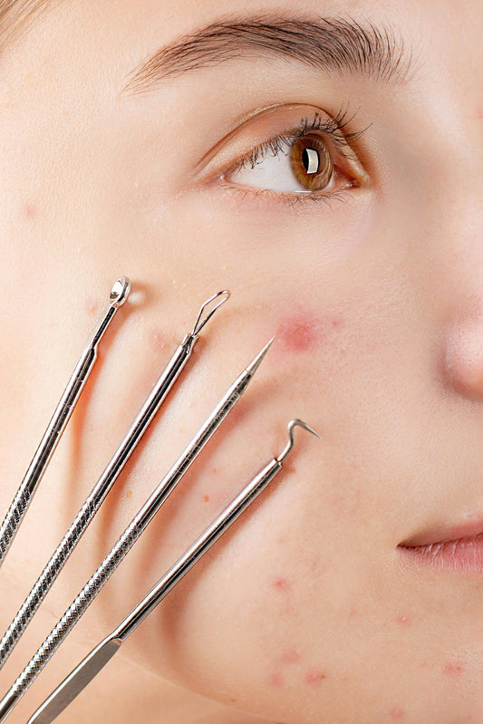 Address the Most Common Skin Problems with Microneedling