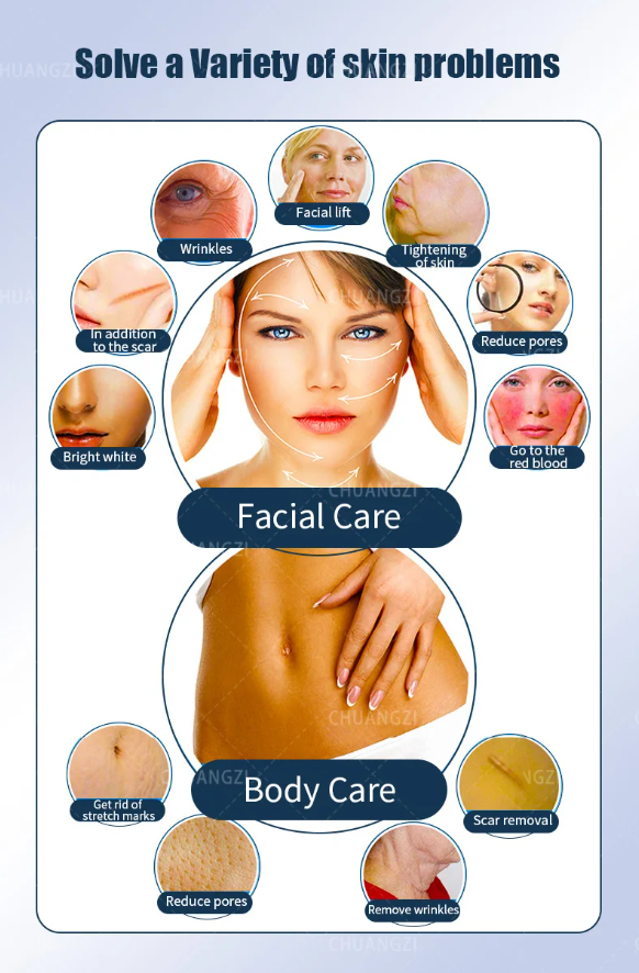 Microneedling Facial Lifting Machine Scar Freckle Fine Lines RF Radio Frequency Skin Care Beauty Machine for Skin Elasticity