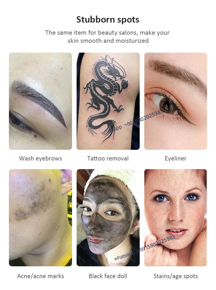 Non-Invasive Optical and Painless Freckle Removal, Tattoo Removal, Eyebrow Removal - Laser Remove Carbon Peeling Beauty Machine