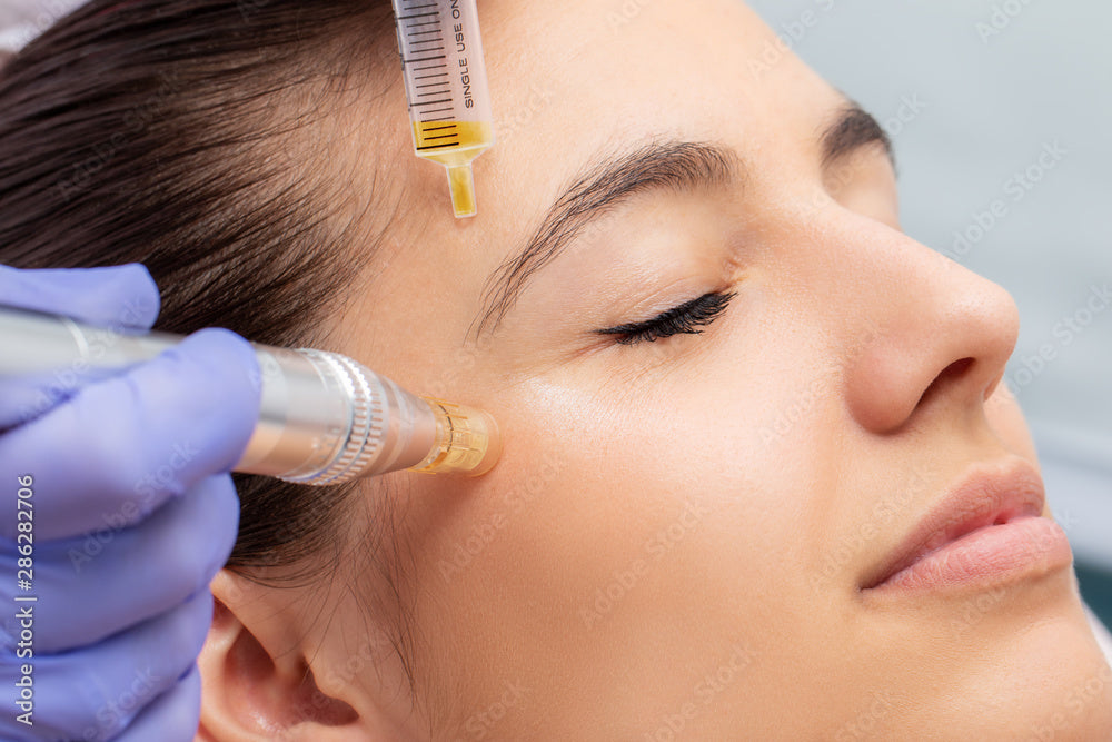 The Ultimate Radio Frequency Microneedling Machine Guide