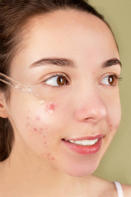 How to Remove Pimple Scars Quickly?