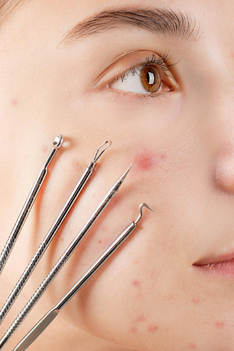 Address the Most Common Skin Problems with Microneedling