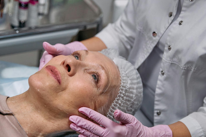 Does Age Matter? Know the Recommended Age for Microneedling